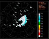 W_20111107_161138_PPI_049